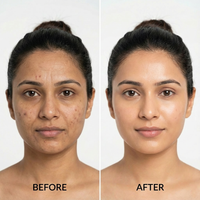 Dr. Nuro DermaLight 3-in-1 LED Therapy Mask -Reverse Signs of Aging, Fading Spots & Acne Marks — Boost Collagen & Glow from Within